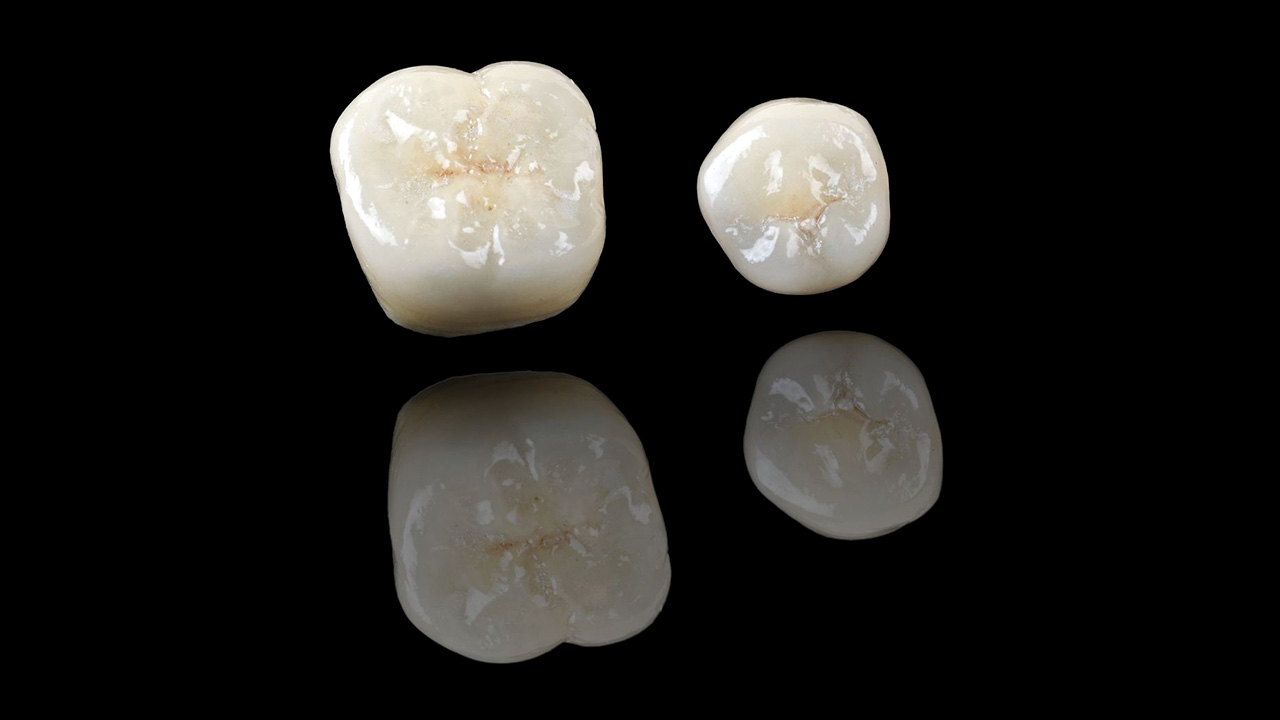 Full Porcelain / Zirconia Crowns LQ Dental
